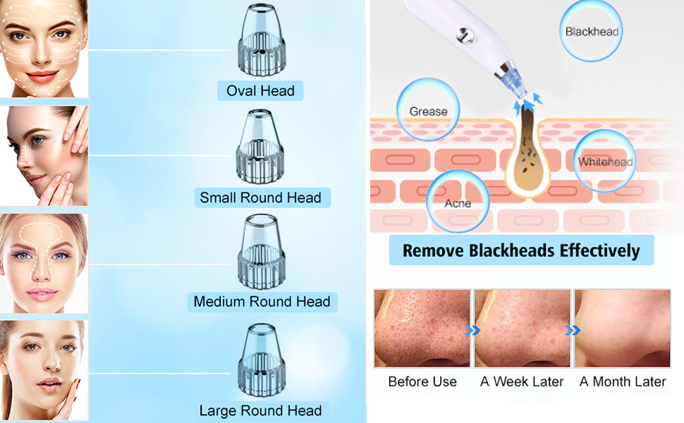 Derma Suction Facial Pore Cleanser By Zelriya - Zelriya