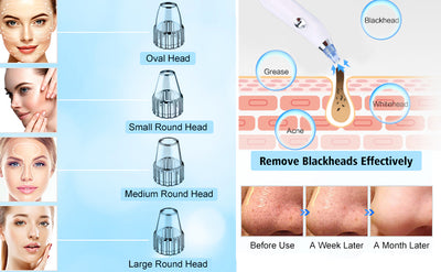 Derma Suction Facial Pore Cleanser By Zelriya - Zelriya